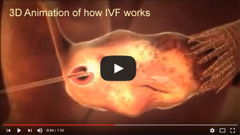 3D Animation of How IVF Works