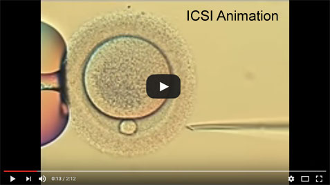 ICSI Animation